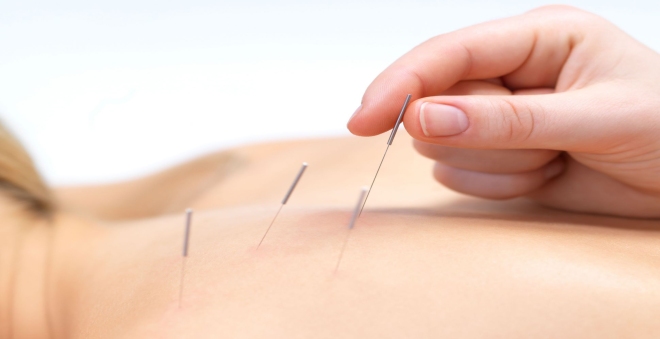 Acupuncture for hot Flushes_north side acupuncture